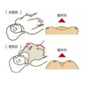 怀孕乳房下垂怎么纠正？方法是什么啊,孕期胸下垂正常吗