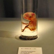 胎儿标本（dna标本保存怎么收费）