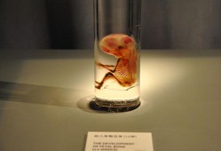 胎儿标本（dna标本保存怎么收费）