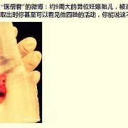被打掉的胎儿（女朋友怀孕了把孩子打掉怎么办）