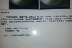 胎儿肾分离怎么吸收（怀孕七个月胎儿双肾集合系统分离是什么原因）