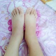 孕期脚不肿的是男孩吗（孕期脚不肿是男孩还是女孩）