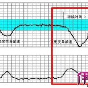 轻松识别胎儿监护图（轻松识别胎儿监护图pdf）