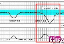 轻松识别胎儿监护图（轻松识别胎儿监护图pdf）