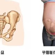 孕期骨盆检查（孕期骨盆检查怎么检查）