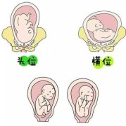什么是胎儿打嗝?胎儿打嗝是什么感觉,胎儿打嗝是哪个部位在动
