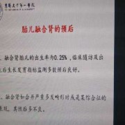 融合肾是什么意思,胎儿融合肾是什么意思