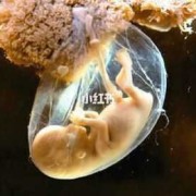 羊水浑浊胎儿能呆多久（孕妇羊水浑浊是什么原因造成的？孕妇羊水浑浊对胎儿有什么）