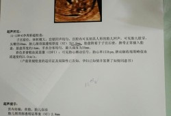 胎儿颈部透明层（胎儿颈部透明层nt多少算最好）