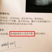 胎儿无胎心原因（胎儿突然没有胎心原因是什么啊？是胎停了吗）