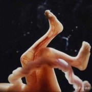 孕妇4个月胎儿图（孕妇4个月胎儿图片）