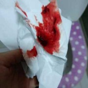 孕期便秘流血（孕期便秘流血会影响胎儿吗）
