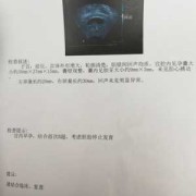 胎儿停止发育还有救吗（胎儿停止发育还有救吗）