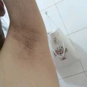孕期腋窝黑（怀孕腋下变黑怎么办）