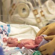 孕妇梦见胎儿早产（孕妇梦见胎儿早产孩子很健康）