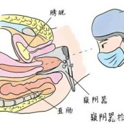 外阴痒，白带常规检查正常，TCT，hpv也正常那是什么原因呢,孕期检查正常胎儿出生就一定正常吗