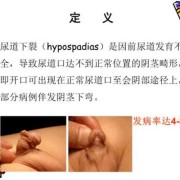 尿道感染会影响胎儿吗（孕晚期尿道感染会影响胎儿吗）