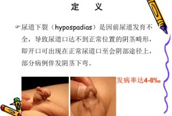 尿道感染会影响胎儿吗（孕晚期尿道感染会影响胎儿吗）