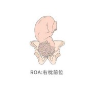 胎儿右枕前位是什么意思（胎儿右枕前位图片示意图）
