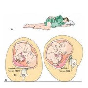 胎儿在肚子左侧（胎儿在肚子左侧还可以左侧睡吗）