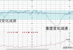 胎儿脉搏（胎儿脉搏）