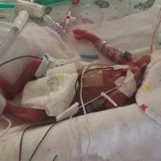 23周宝宝长什么样子,23周胎儿图片真实