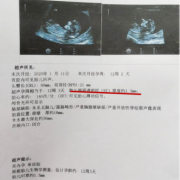 胎儿智力低下（胎儿智力问题产检能查出来吗）