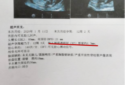 胎儿智力低下（胎儿智力问题产检能查出来吗）