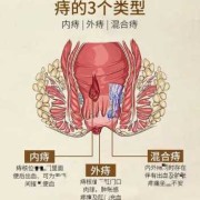 孕期痔疮肉球（孕妇怀孕期间肛门长了一个肉疙瘩，不痛也不痒是怎么回事）