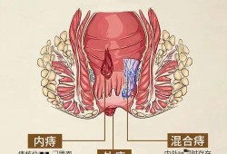 孕期痔疮肉球（孕妇怀孕期间肛门长了一个肉疙瘩，不痛也不痒是怎么回事）