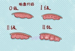 生孩子的时候胎盘一般达到几级,胎儿几周长胎盘开始分泌孕激素