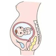 孕期胎位（胎位横位是什么意思）