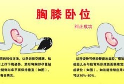 胎儿枕后位怎么纠正（胎儿枕后位怎么纠正）