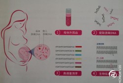 孕期无创检查是什么（什么是无创DNA？都有什么意义）