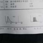 孕期查血型（孕期查血型）