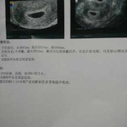 怀孕40天肚子有动静吗,胎儿40天有胎心吗?