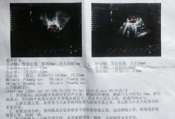 心脏超声检查多少钱,胎儿心脏筛查多少钱一次