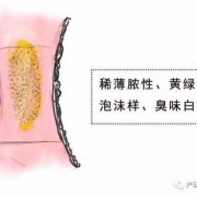 孕期外阴瘙痒分泌物多（孕期下面痒分泌物多）