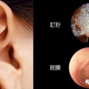孕期流黑色分泌物（孕期流黑色分泌物图片）