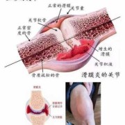 孕期膝盖疼是怎么回事（孕期膝盖疼是怎么回事 女性）