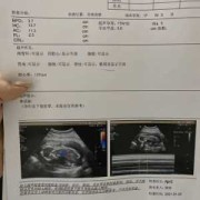 七周的宝宝为什么老闹脾气,怀孕七周胎儿图片欣赏 彩超