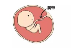 胎儿脐带短影响智力吗（怎么给胎宝宝说让他不要玩脐带）