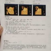 孕期四维检查（做四维检查主要是查哪些）