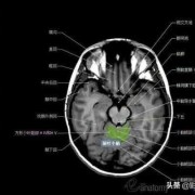 四个月宝宝做头颅核磁共振需要注意什么,胎儿磁共振多少钱一次
