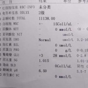 孕期尿葡萄糖3个加（孕期尿葡萄糖3个加号是怎么回事）