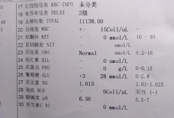 孕期尿葡萄糖3个加（孕期尿葡萄糖3个加号是怎么回事）