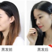 怀孕奶头变黑怎么回事？正常嘛,孕期头发变黑怎么回事