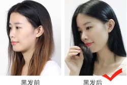 怀孕奶头变黑怎么回事？正常嘛,孕期头发变黑怎么回事