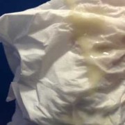 孕期白带酸味