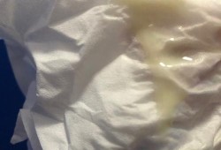 孕期白带酸味